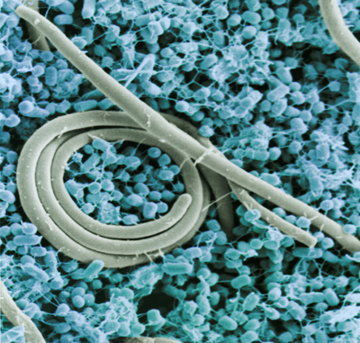 肠炎沙门氏菌。图片来源:美国农业部。通过维基共享获得。点击查看更多信息。