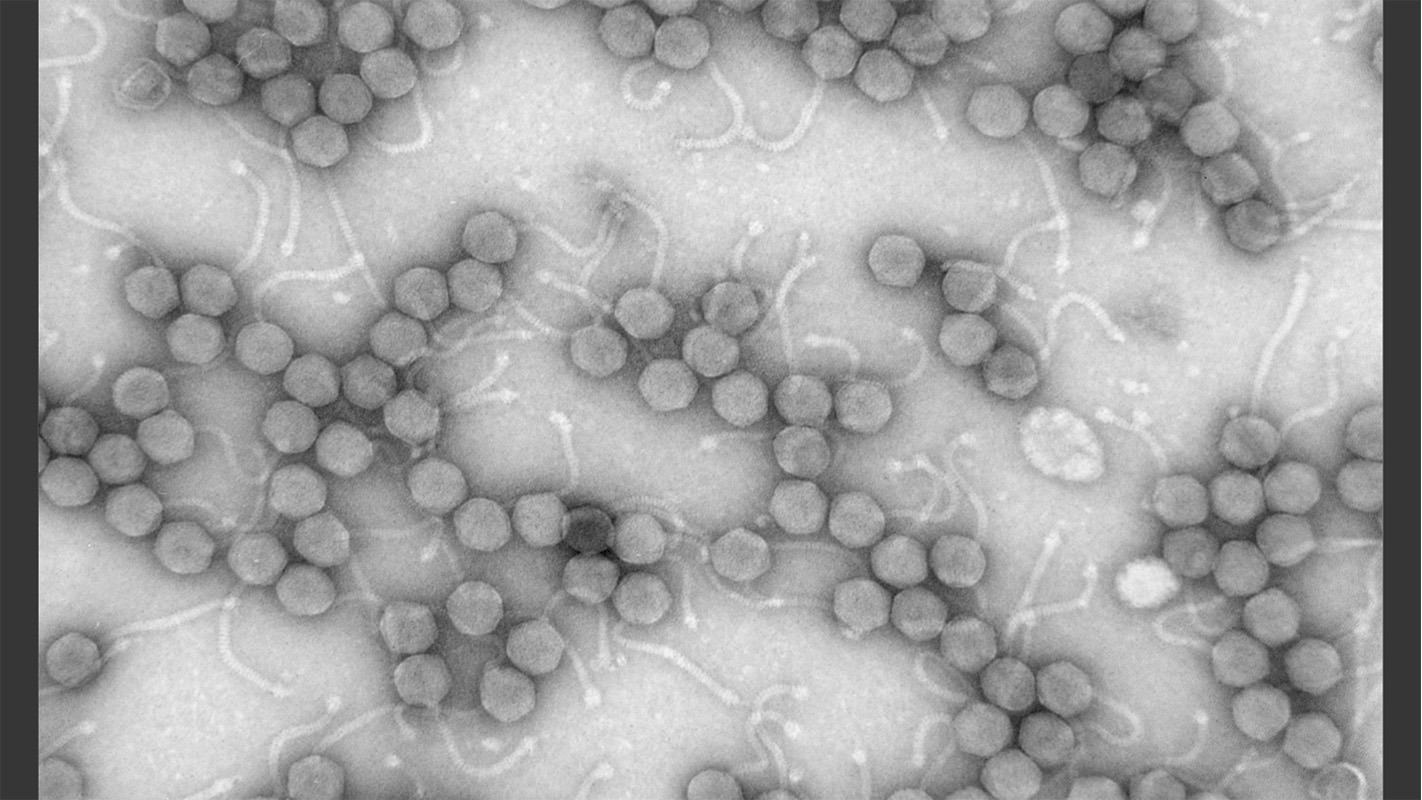小的噬菌体照片从实验室采取的。