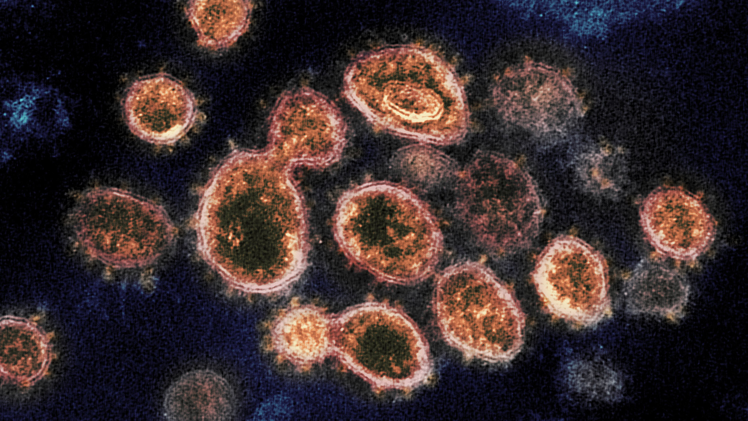 SARS-CoV-2病毒的电子显微镜图像。