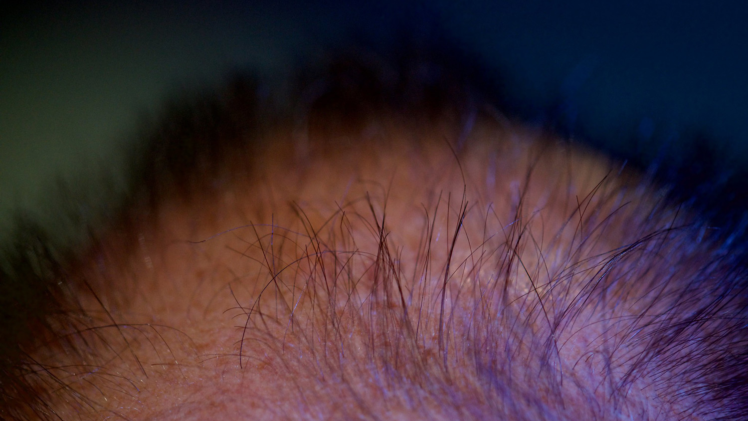 一个男人的头部，失去了头发