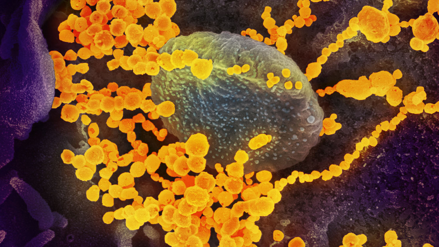 SARS-COV-2病毒的显微镜图像