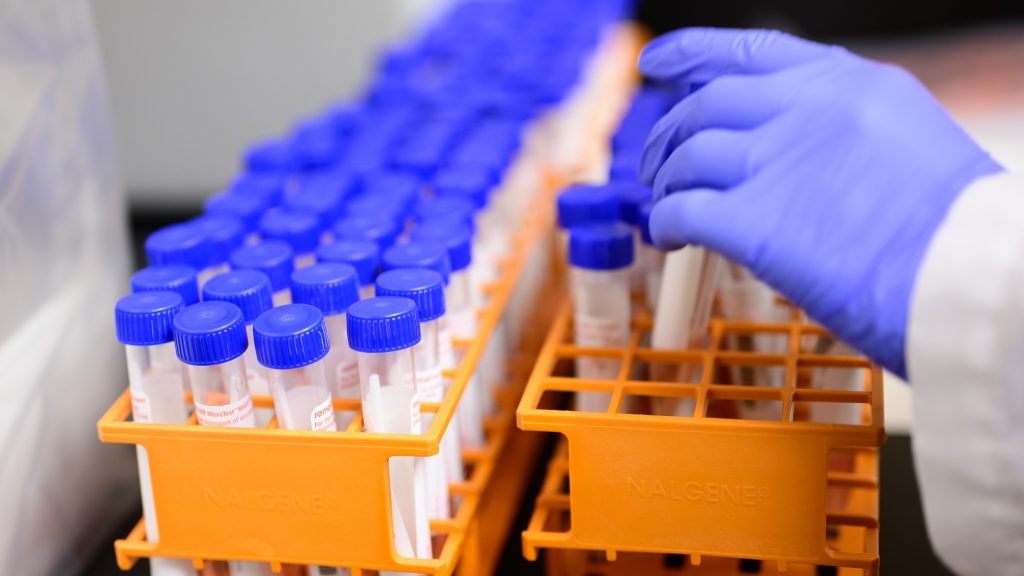 Covid-19监视测试中的手套手册。