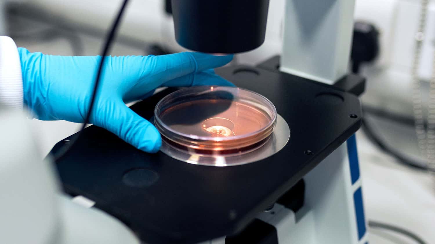 研究人员将培养皿放在显微镜下观察